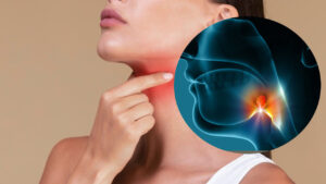 Oral sex becomes the leading cause of throat cancer